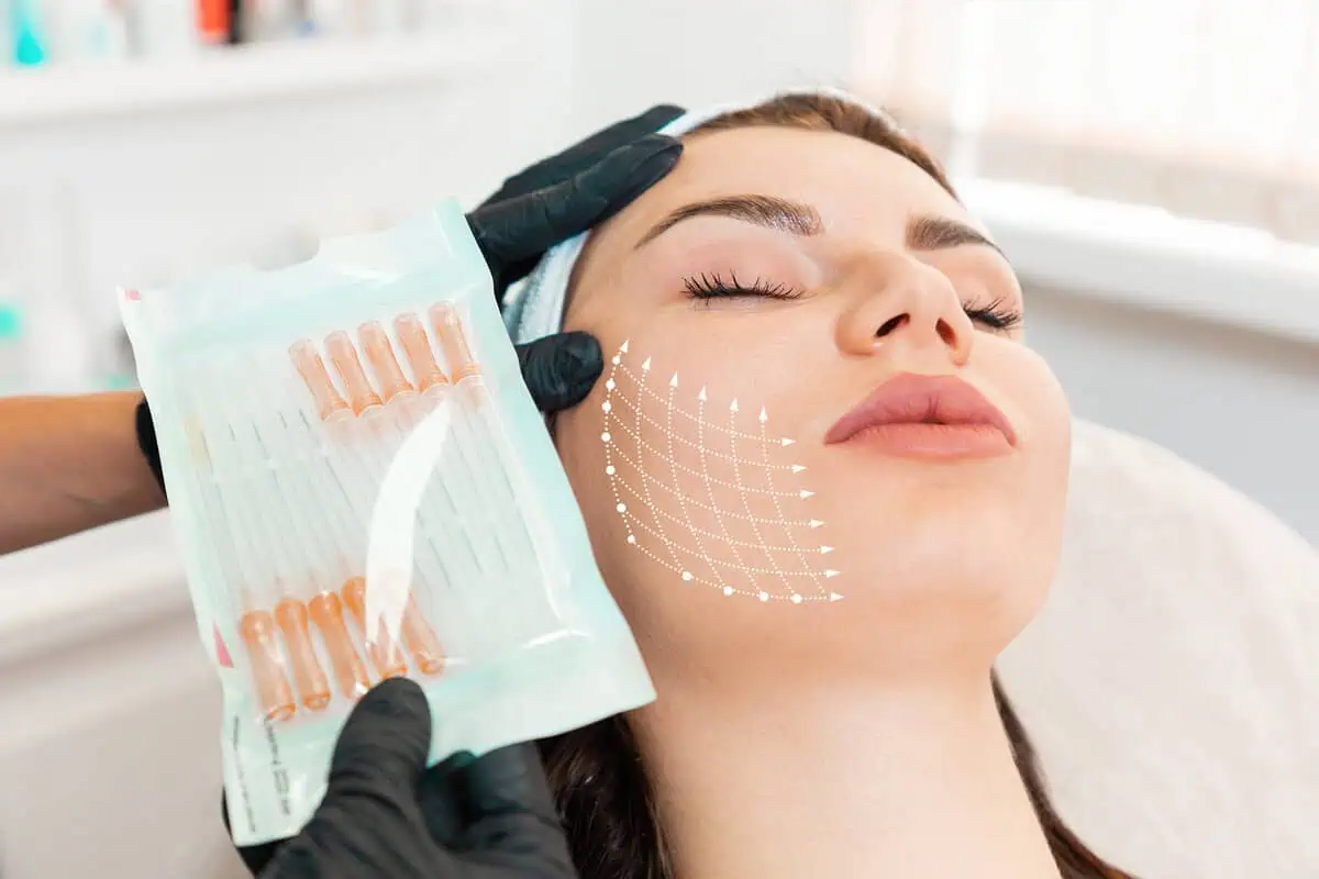 Aftercare Tips for Microneedling Treatments