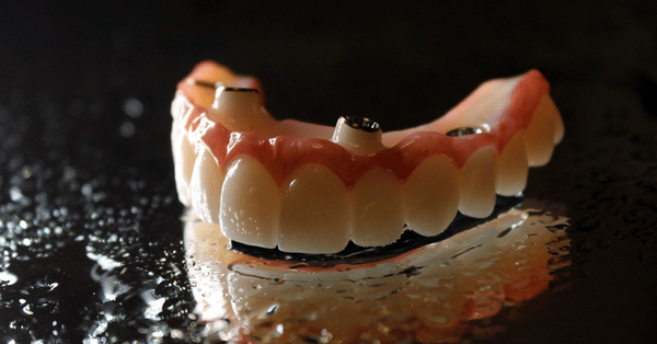 How Dental Implants are a Solution for Missing Teeth That Lasts a Lifetime
