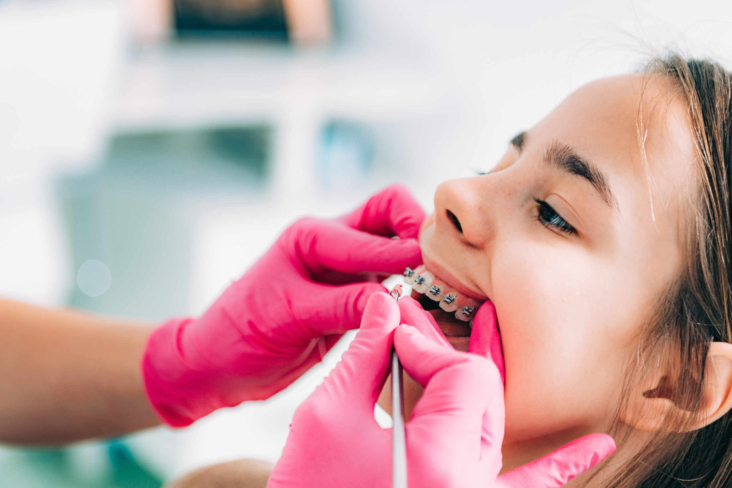 The Role of Early Orthodontic Evaluations for Children