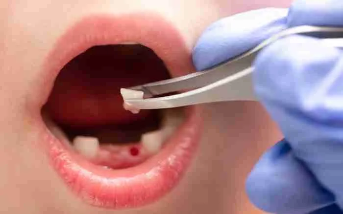 What To Know Before Receiving Emergency Dental Care