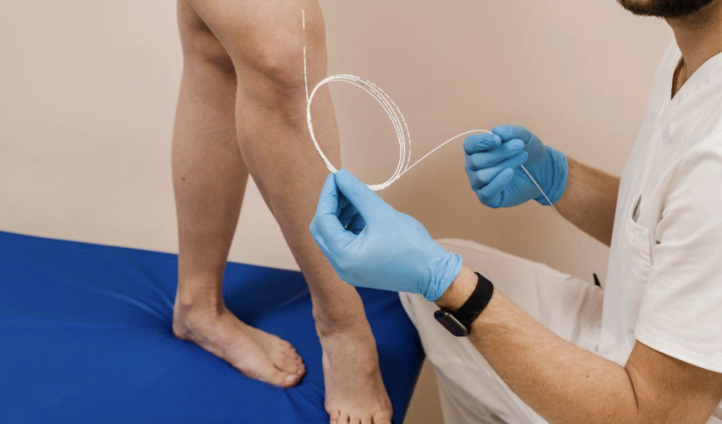 How To Recognize the Signs That You Need To Visit a Vein Clinic