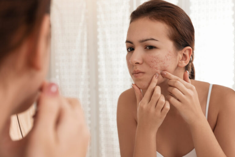 Understanding How a Dermatologist Can Help With Different Skin Conditions