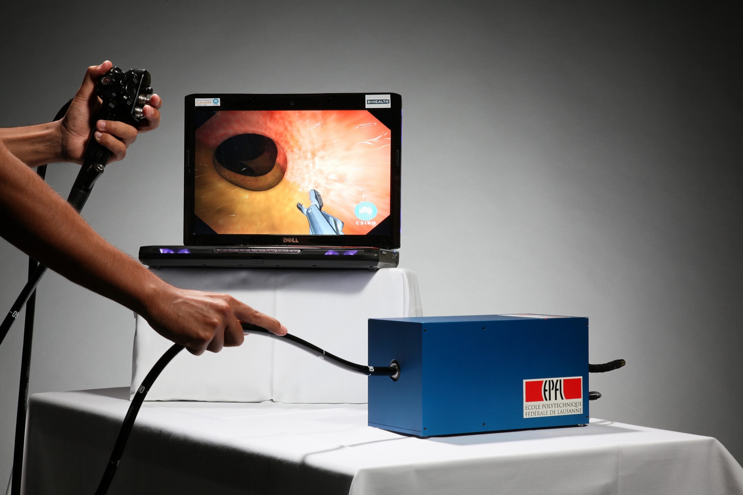 What Technology Is Used in Colonoscopy Procedures?