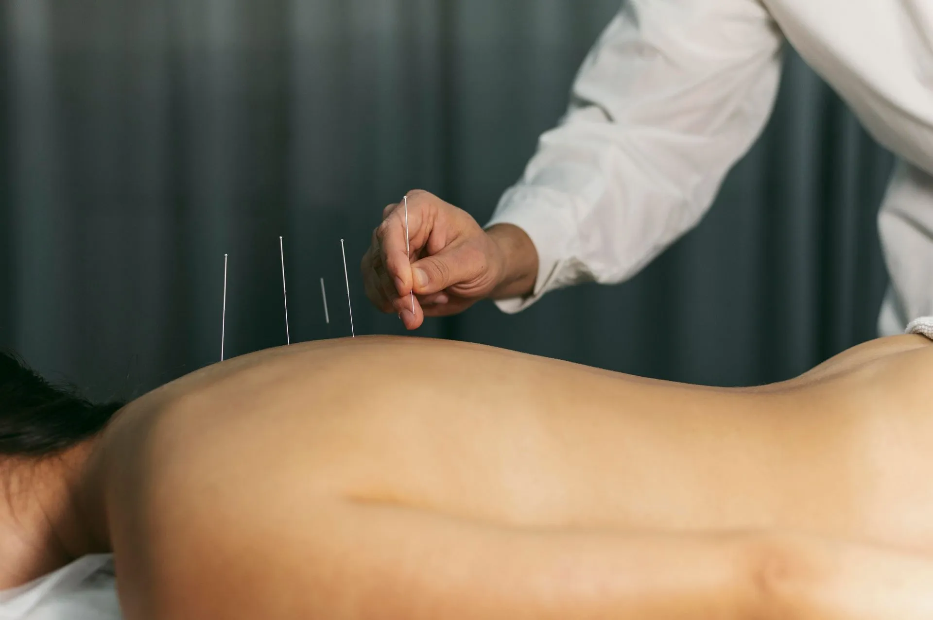 Common Misconceptions About Acupuncturists and Their Practices
