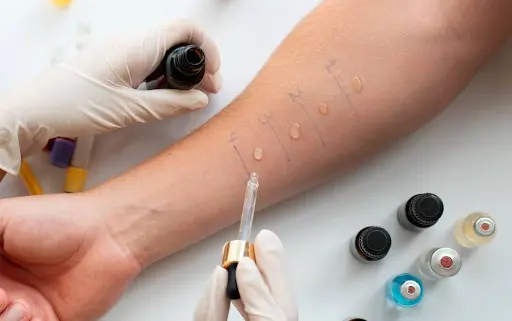 Innovations in Allergy Testing