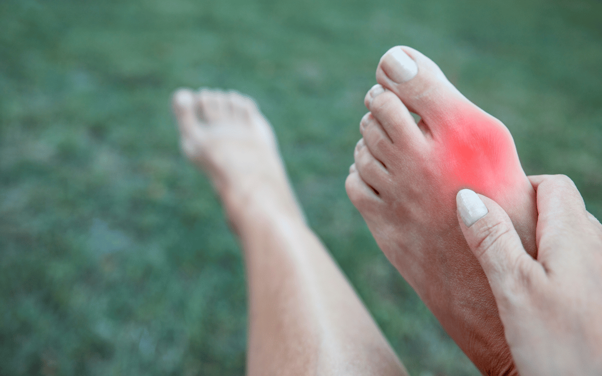 Lifestyle Changes to Alleviate Bunion Discomfort